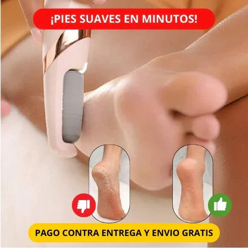 FootCare Pro™ – Elimina Callos
